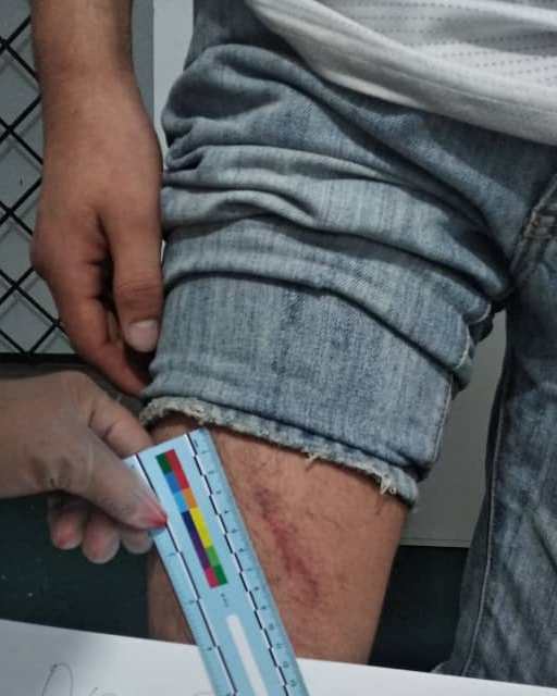 В Сузакском районе заключенные ИВС РОВД пожаловались на избиения
