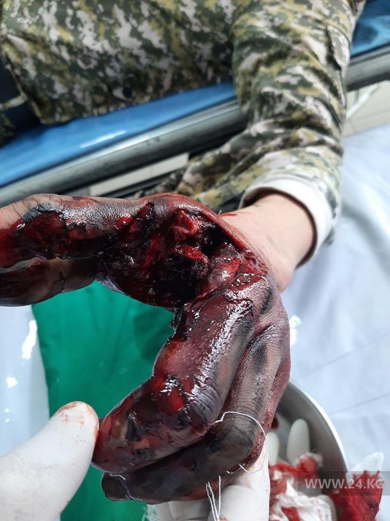 ЧП произошло во время учений
