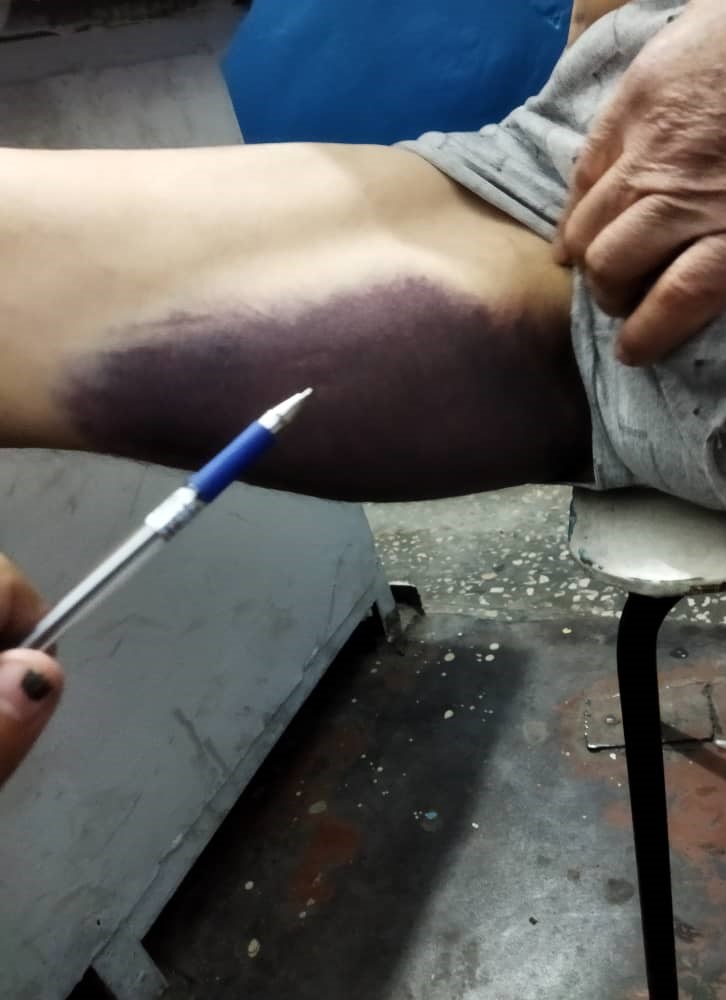 Избиение задержанного в ИВС Ноокенского района Джалал-Абадской области