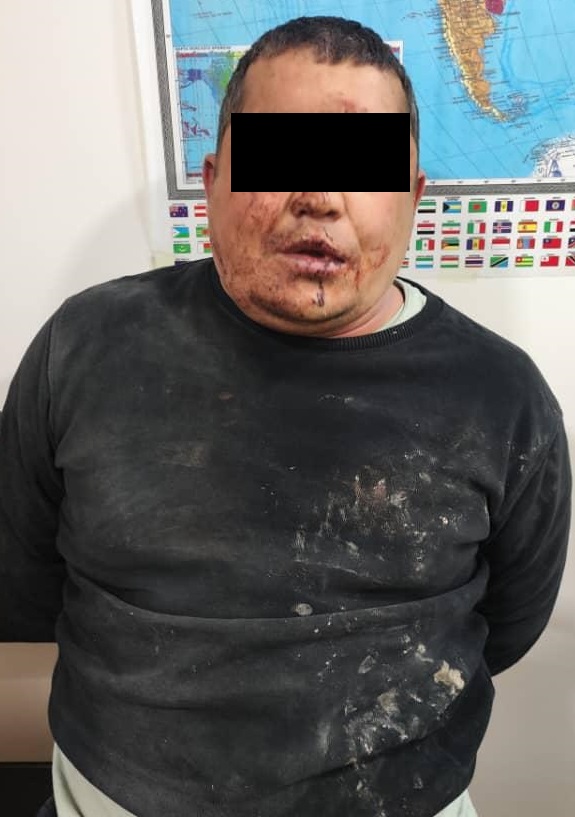 У задержанного спецслужбами мужчины видны ссадины и кровоподтеки