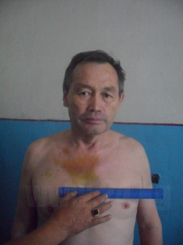 «Кылым Шамы». Сапар Аргымбаев после избиения