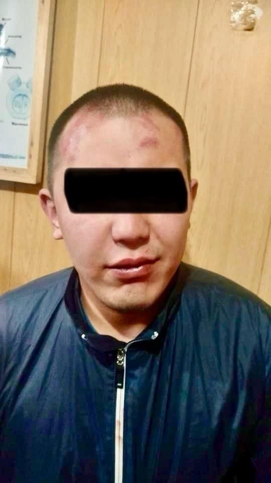 Участник драки