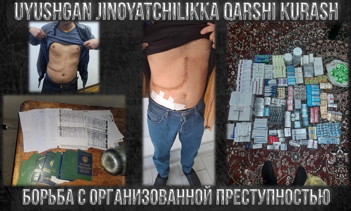 В Узбекистане задержали преступную группу за незаконную продажу органов