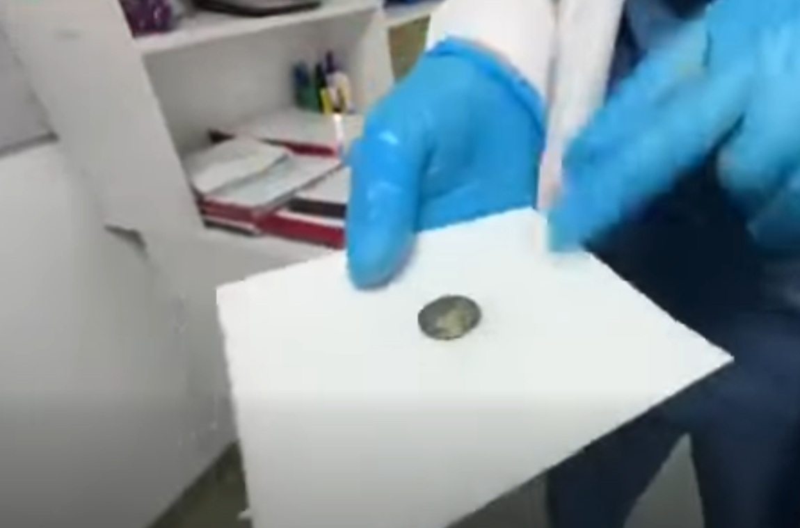 Извлеченная врачами батарейка