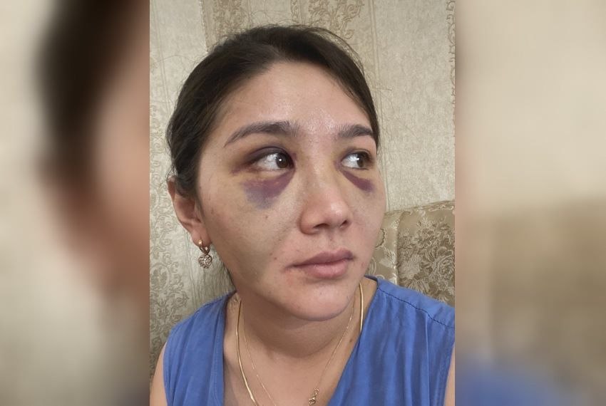 Родственники погибшей заявляют, что она систематически подвергалась домашнему насилию