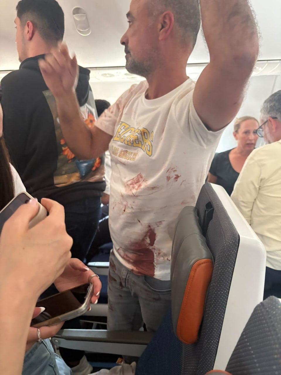 Пассажир в крови, который якобы разнимал пилотов